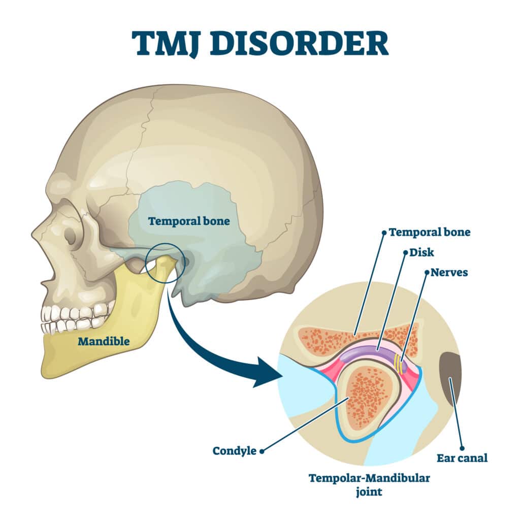 image of temporal bone and skull