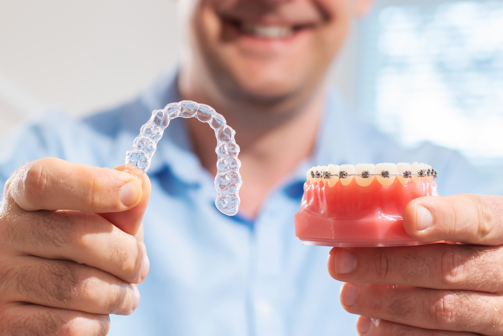 image of doctor with invisalign 