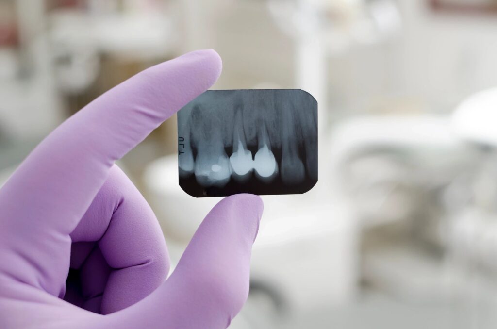 image of dental xray