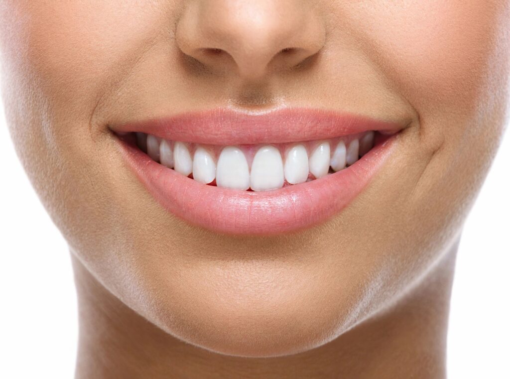 picture of person with white teeth